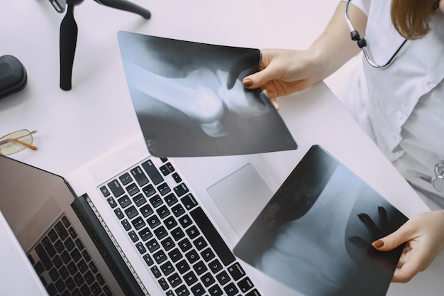 자궁근종 치료 및 원인