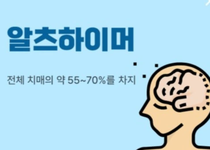 알츠하이머