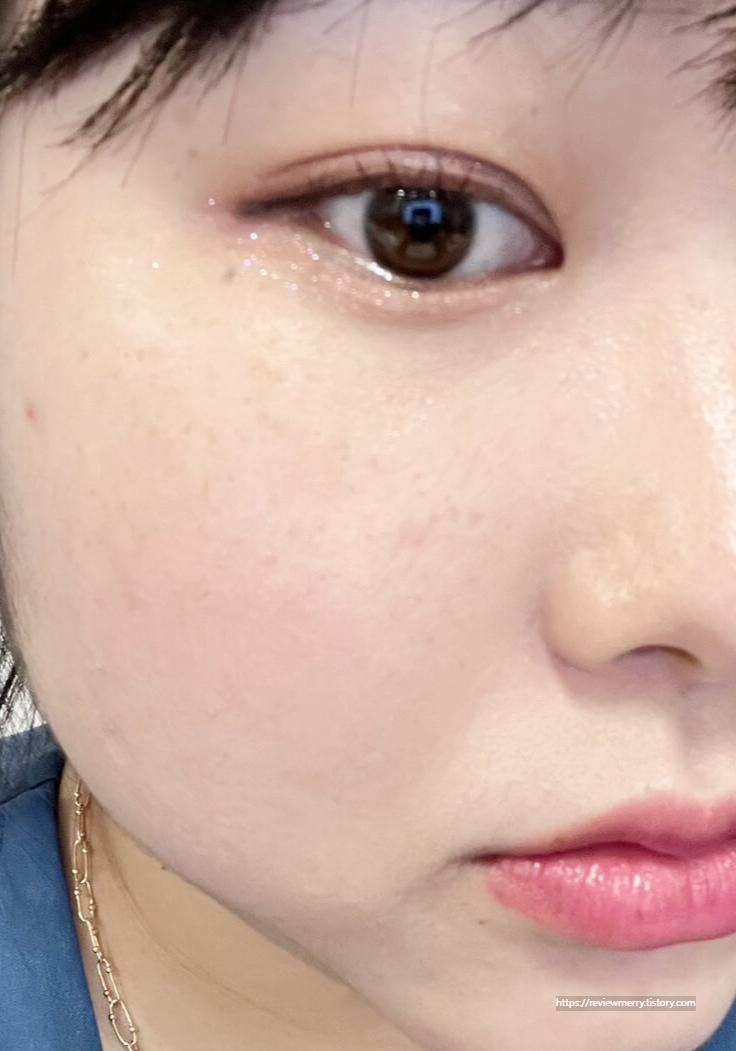 6시간 후 좌측 볼