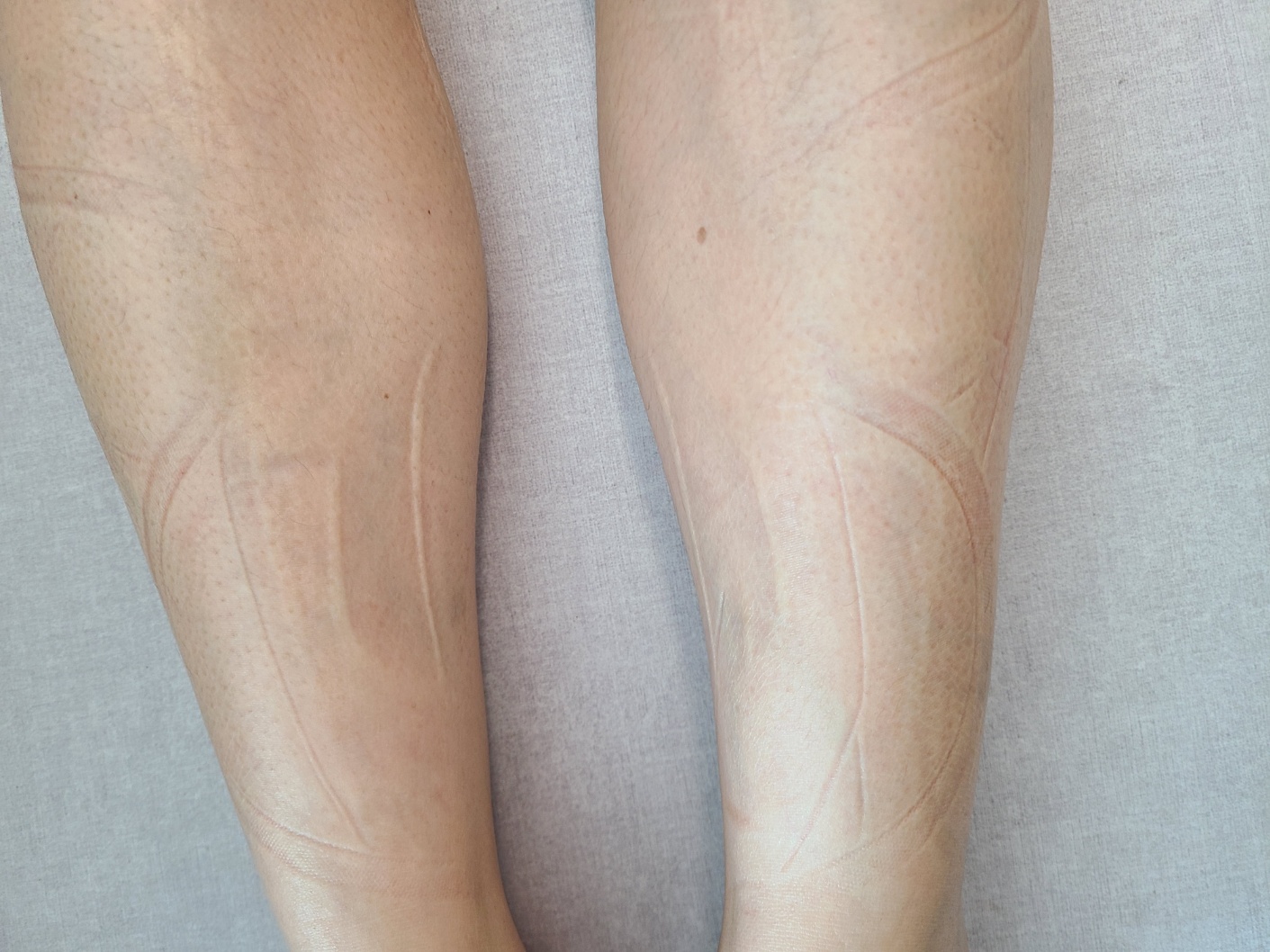 풀리오 종아리 마사지기