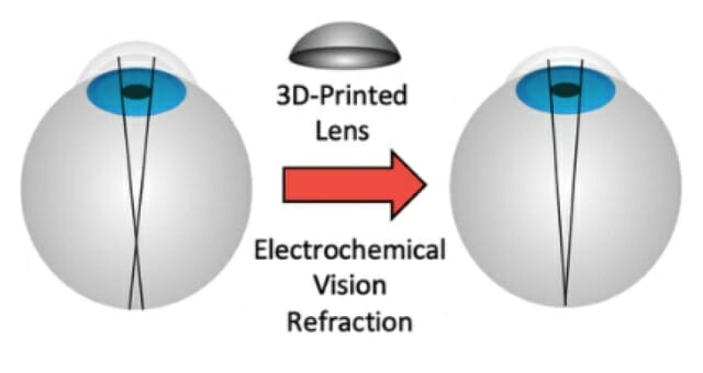 전기기계적 재형성(EMR) 기법을 설명한 그림