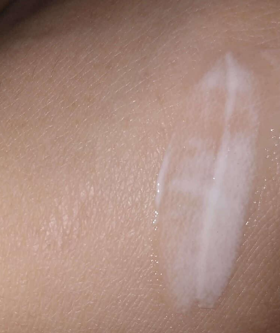 비판텐 연고를 펴 바른 모습