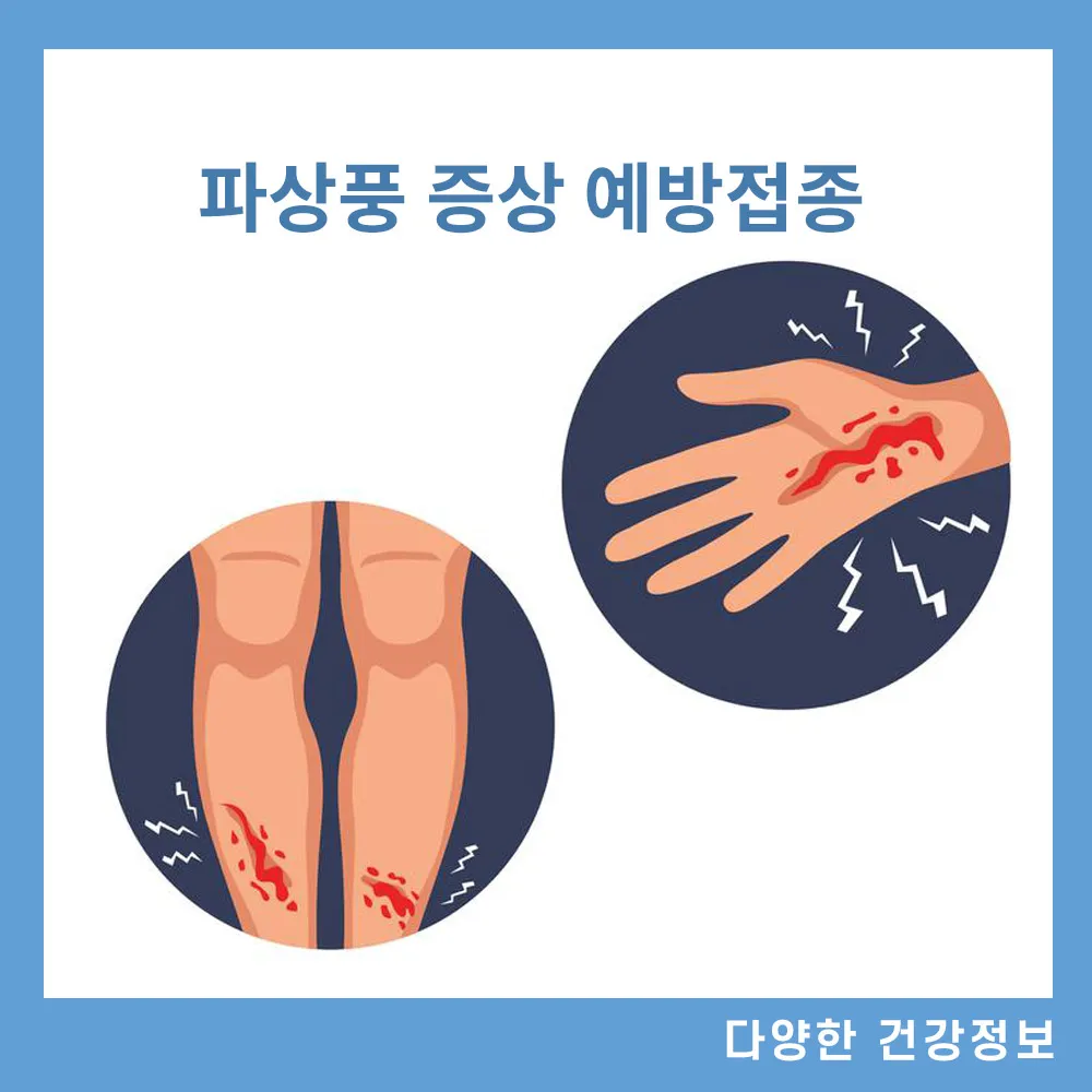 파상풍-증상-예방접종-주사-가격