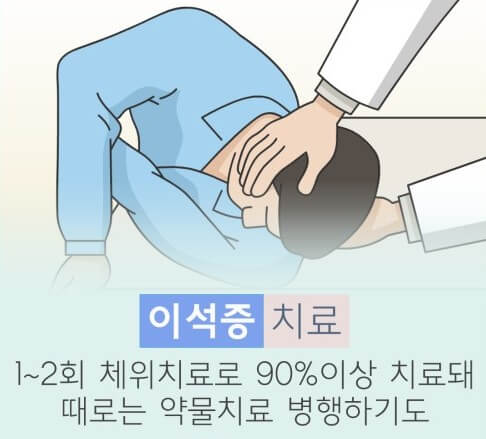 이석증 치료