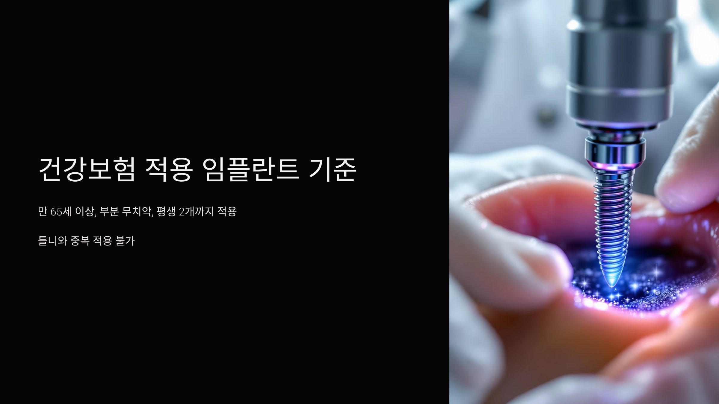 건강보험 적용 임플란트 기준