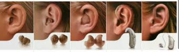 청각장애인 보청기 지원 확대 핵심 정리: 바로 지금 신청하기!