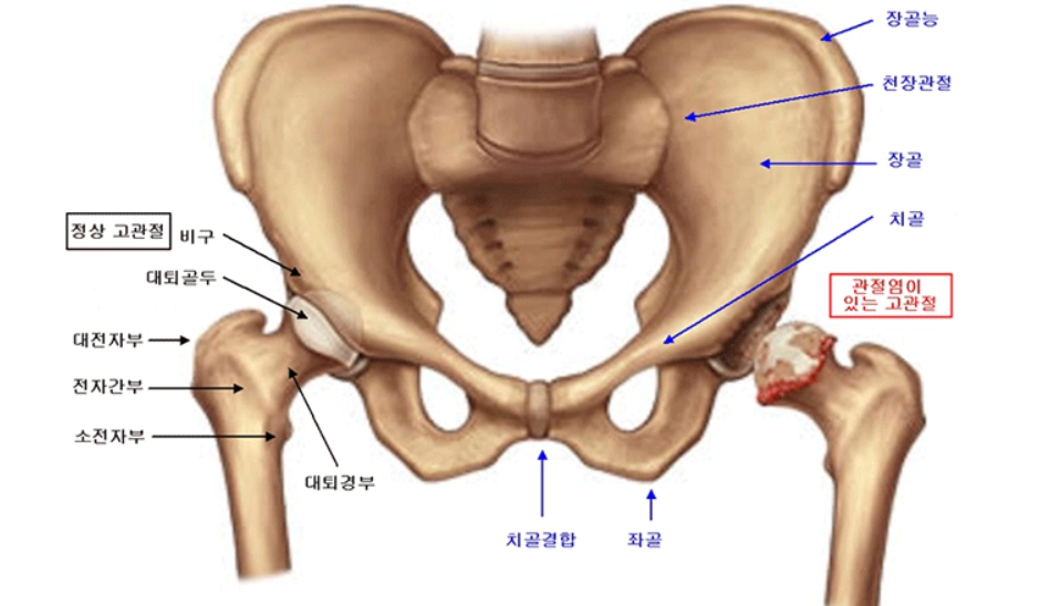 고관절
