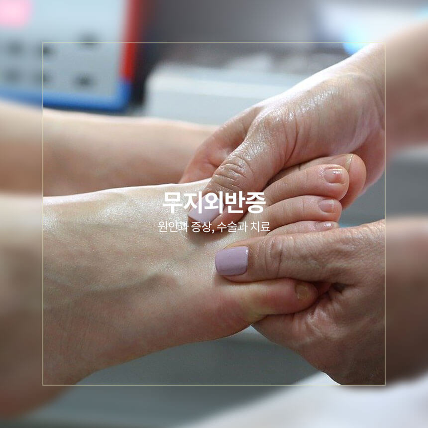 무지외반증 원인, 증상, 수술, 치료