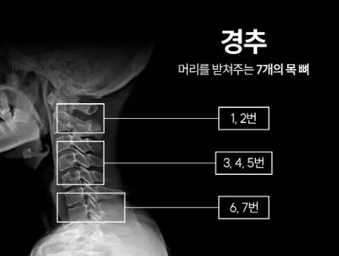 풀리오 넥풀러 경추