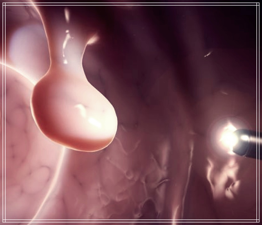 양성 종양과 악성 종양의 차이점