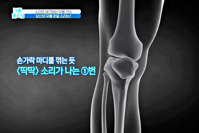 무릎에서 뚝뚝 소리 나는 이유, 앉았다 일어나면 무릎에서 소리가 나요, 무릎에서 소리나고 통증, 건강 팁줌 매일꿀정보