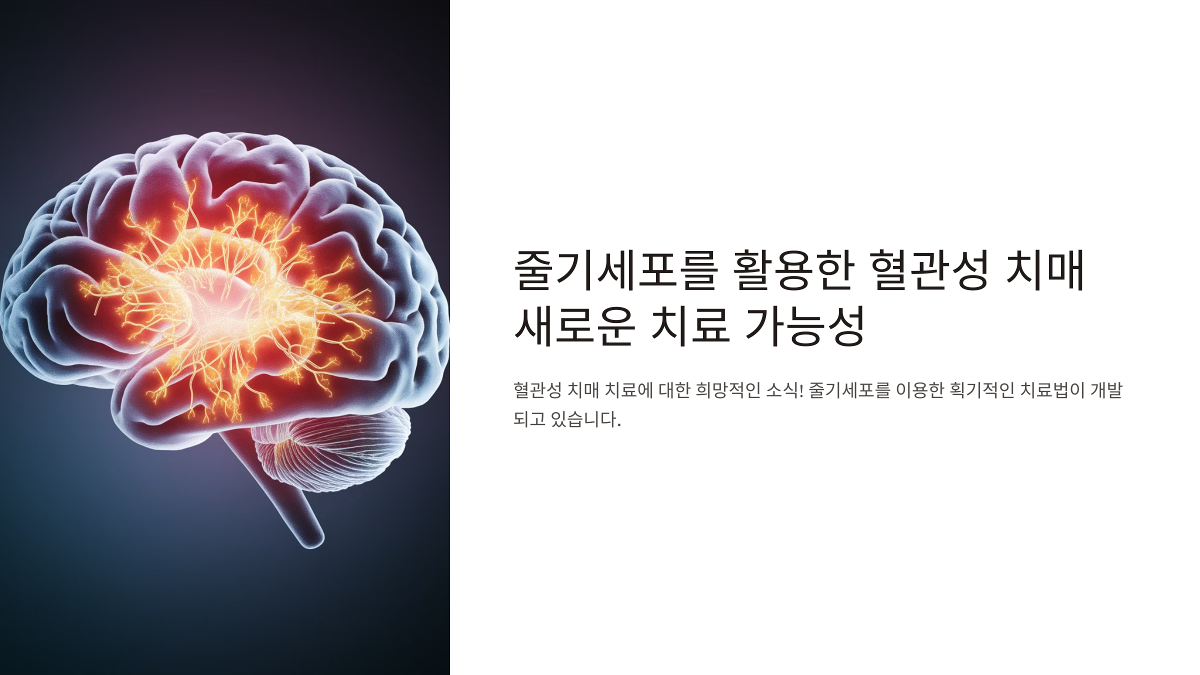 줄기세포 치료