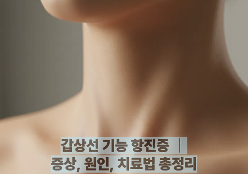 갑상선 기능 항진증 ｜증상, 원인, 치료법 총정리