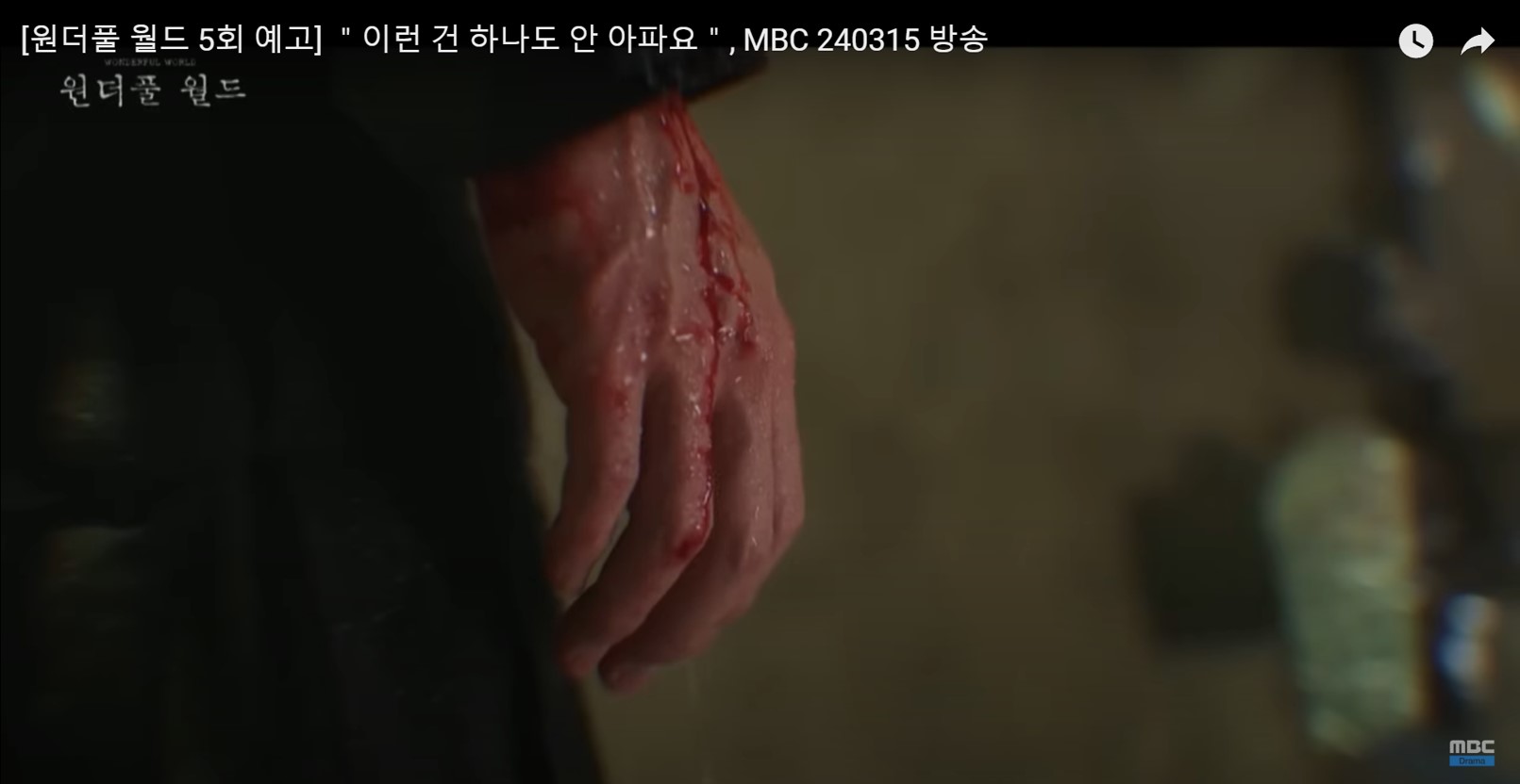 원더풀 월드 5회 선율 다치는 장면
