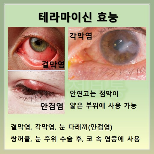 안연고: 개요 및 활용