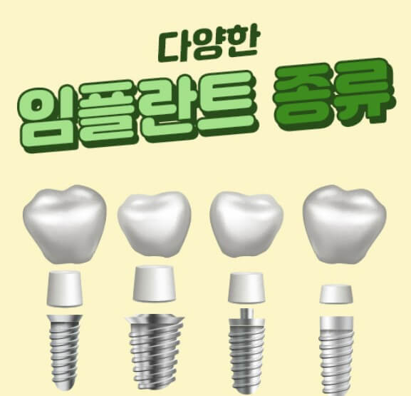 다양한 임플란트