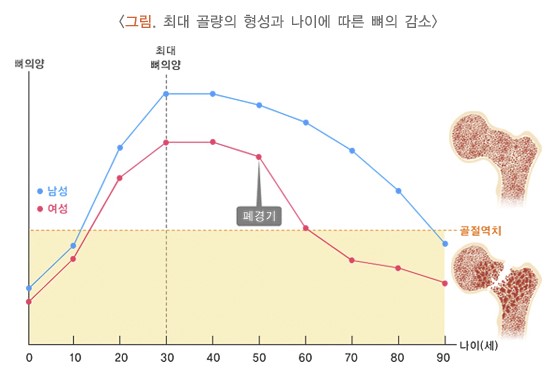연령과 성별에 따른 골밀도 형성 그래프