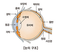 결막염 증상