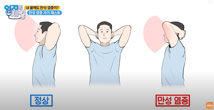 만성염증자가진단법