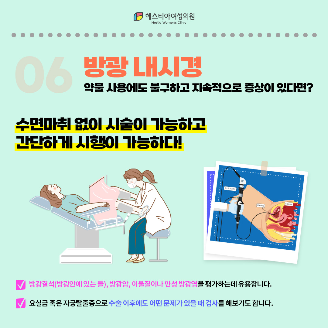 요실금 검사 다섯번째, 방광 내시경