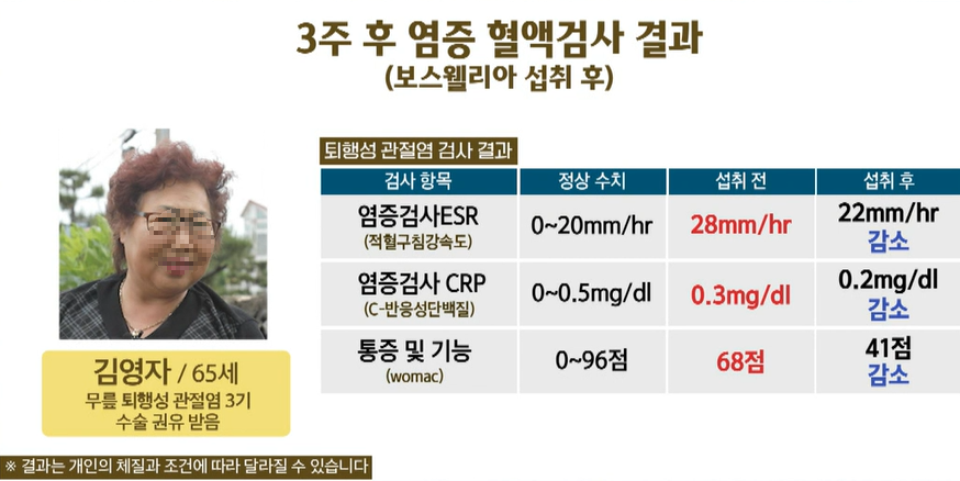 보스웰리아 효능