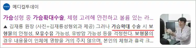 가슴 확대 수술 보형물, 모유 수유 영향 기사