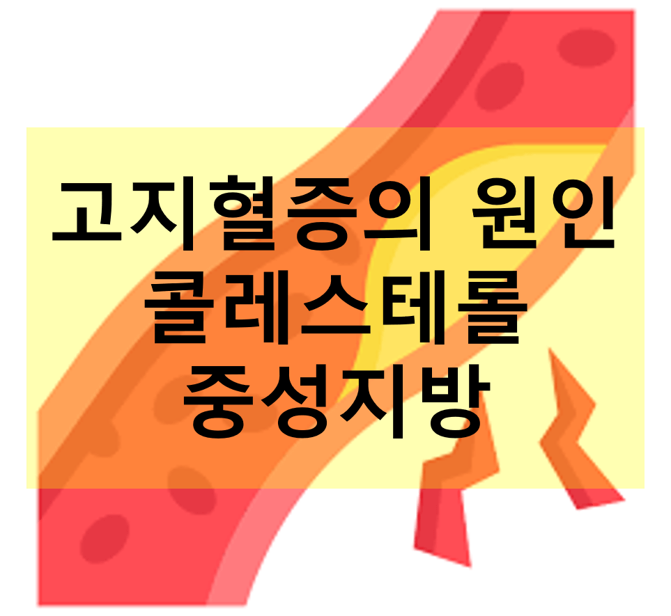 고지혈증