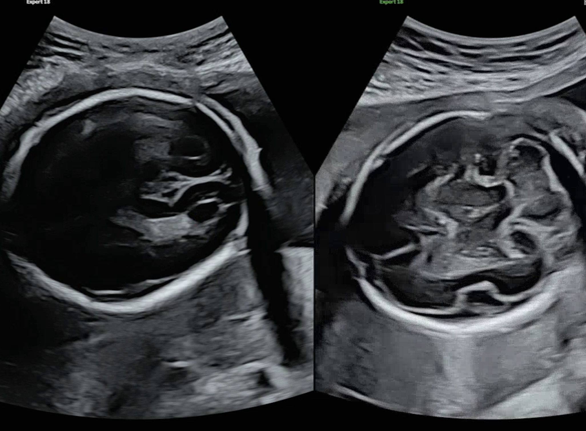 분류 클래스 예시 (na_xxx)