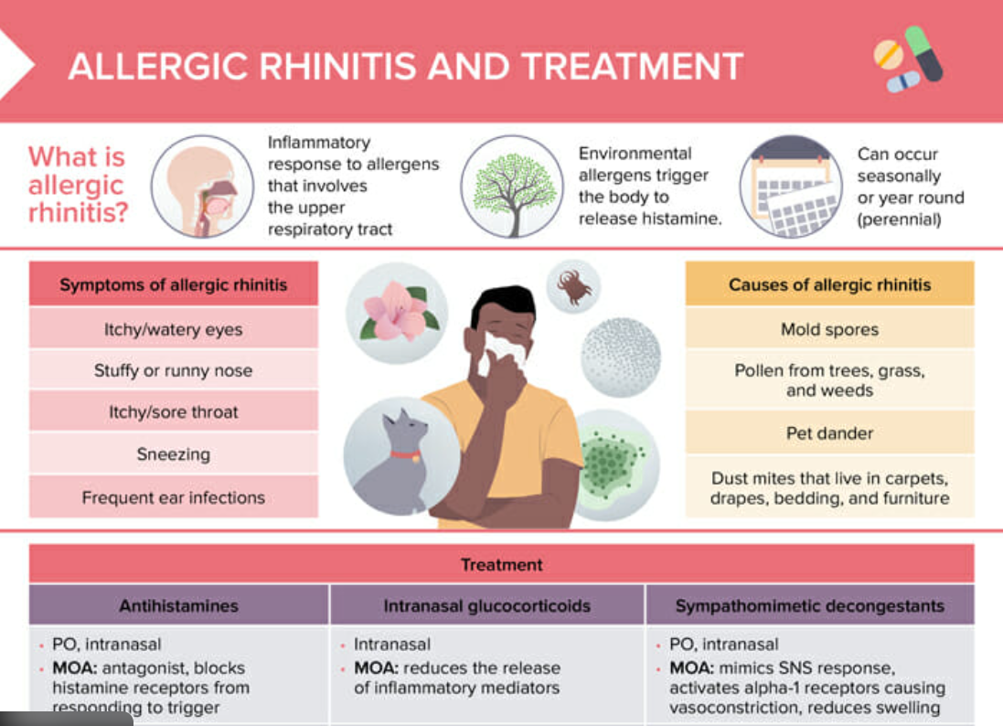비염 원인과 발생 메커니즘 인포그래픽