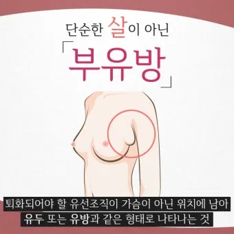 여자 오른쪽 겨드랑이 콕콕 유방암 증상일까 놓치기 쉬운 신호로_15