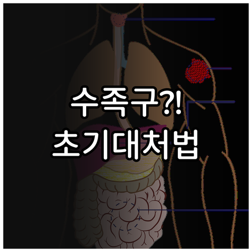 수족구 초기 증상 대처법과 연제구 병..