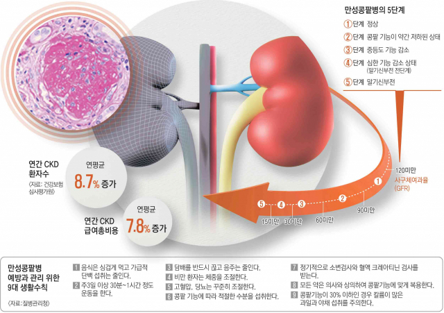 콩팥이 안좋으면 나타나는 증상 콩팥 건강 이상 신호 나빠지는 이유