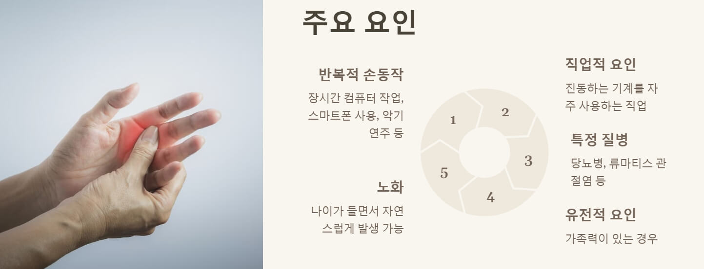 방아쇠 수지 증후근 원인 치료 수술