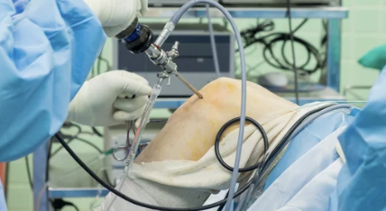 관절내시경 수술