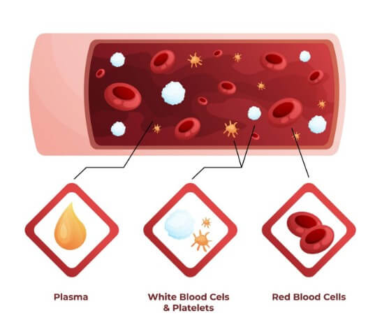 혈관 속 노폐물의 정도
