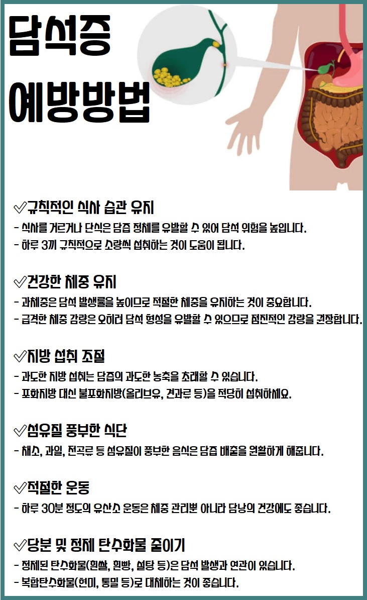 담석증 예방방법