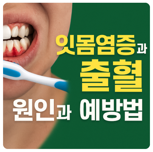 잇몸염증과 출혈, 원인부터 예방법