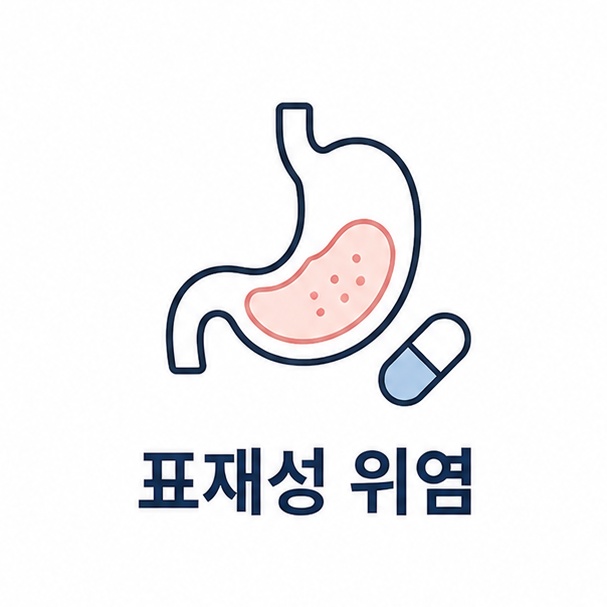 표재성 위염 대표 이미지, 위 모양을 단순화한 선 도형과 알약을 그린 일러스트
