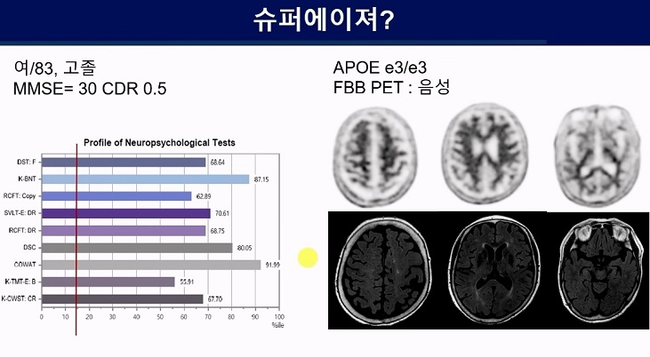 중년의뇌를갖는방법-슈퍼에이저