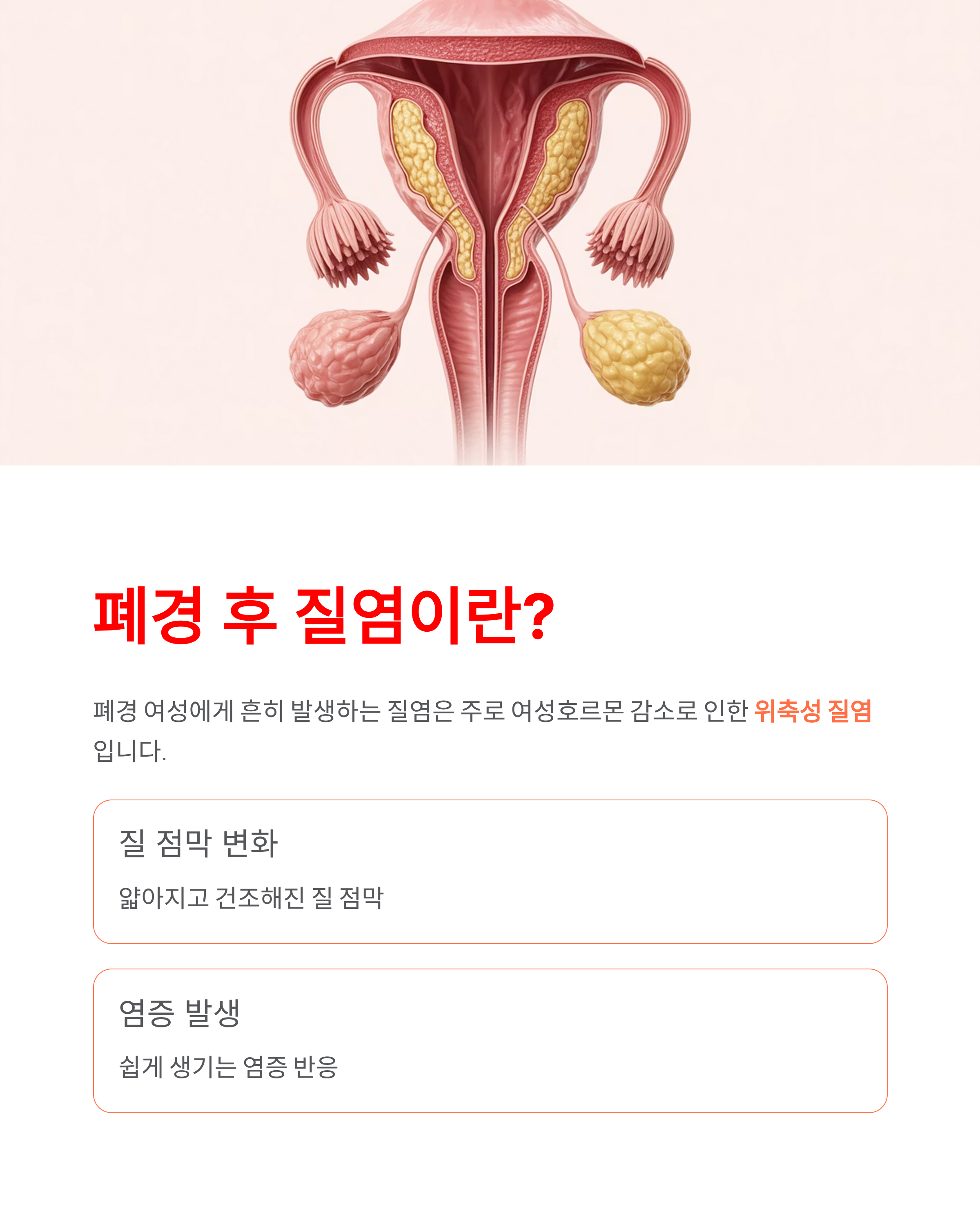 폐경 후 질염(원인,증상,치료방법,관리법)왜 생기고 어떻게 관리해야 할까요?