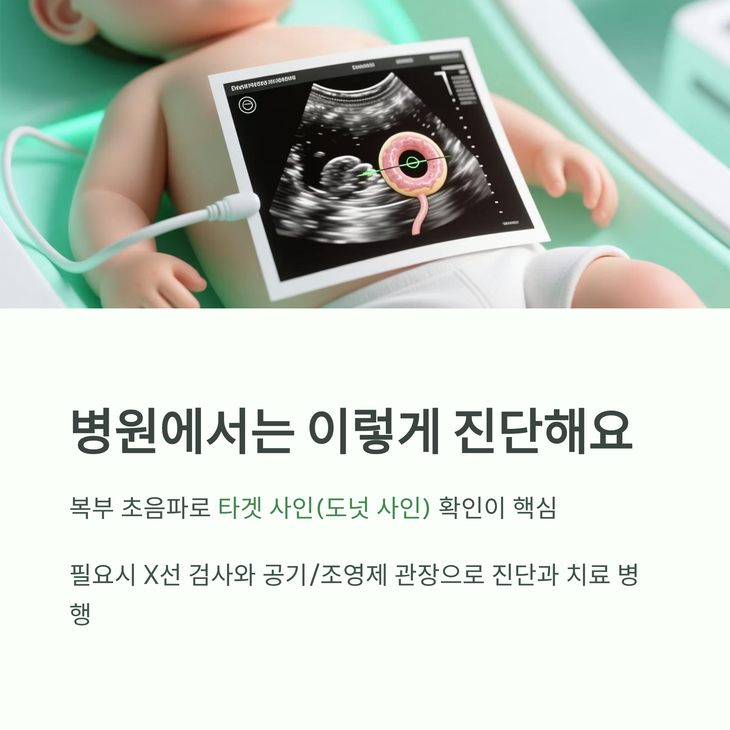 병원에서 장 중첩증을 진단하는 과정(초음파, X선 등)을 설명한 이미지