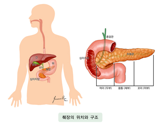 췌장암 초기 증상