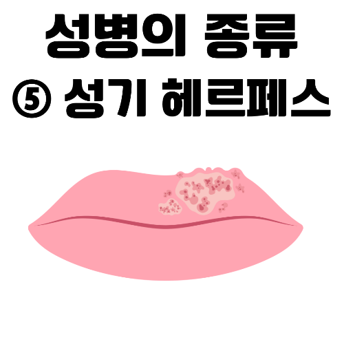 성기 헤르페스, 성매개 감염, 성병, 단순포진 바이러스, HSV-1, HSV-2, 초기 감염, 재발성 감염, 수포, 궤양, 항바이러스제, 아시클로버, 발라시클로버, 파미클로버, PCR 검사, 항체 검사, 재발 예방, 성적 접촉, 성병 예방, 콘돔 사용, 면역력 강화, 신생아 헤르페스, 스트레스 관리, 성건강, 성병 치료, 안전한 성관계, 정신적 스트레스.