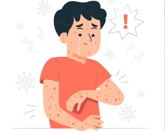 땀띠-원인-증상-없애는-방법-3