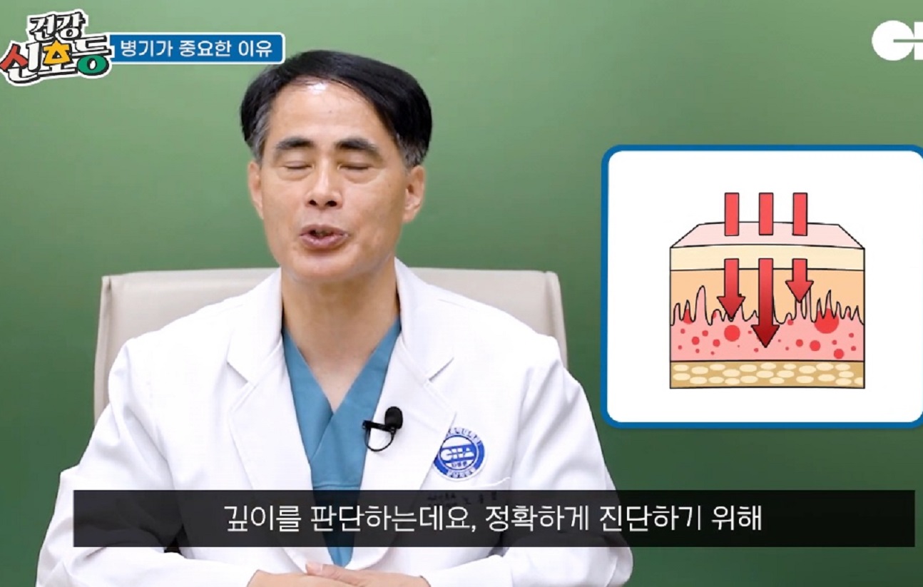 EBS-명의-구강암-자가진단법