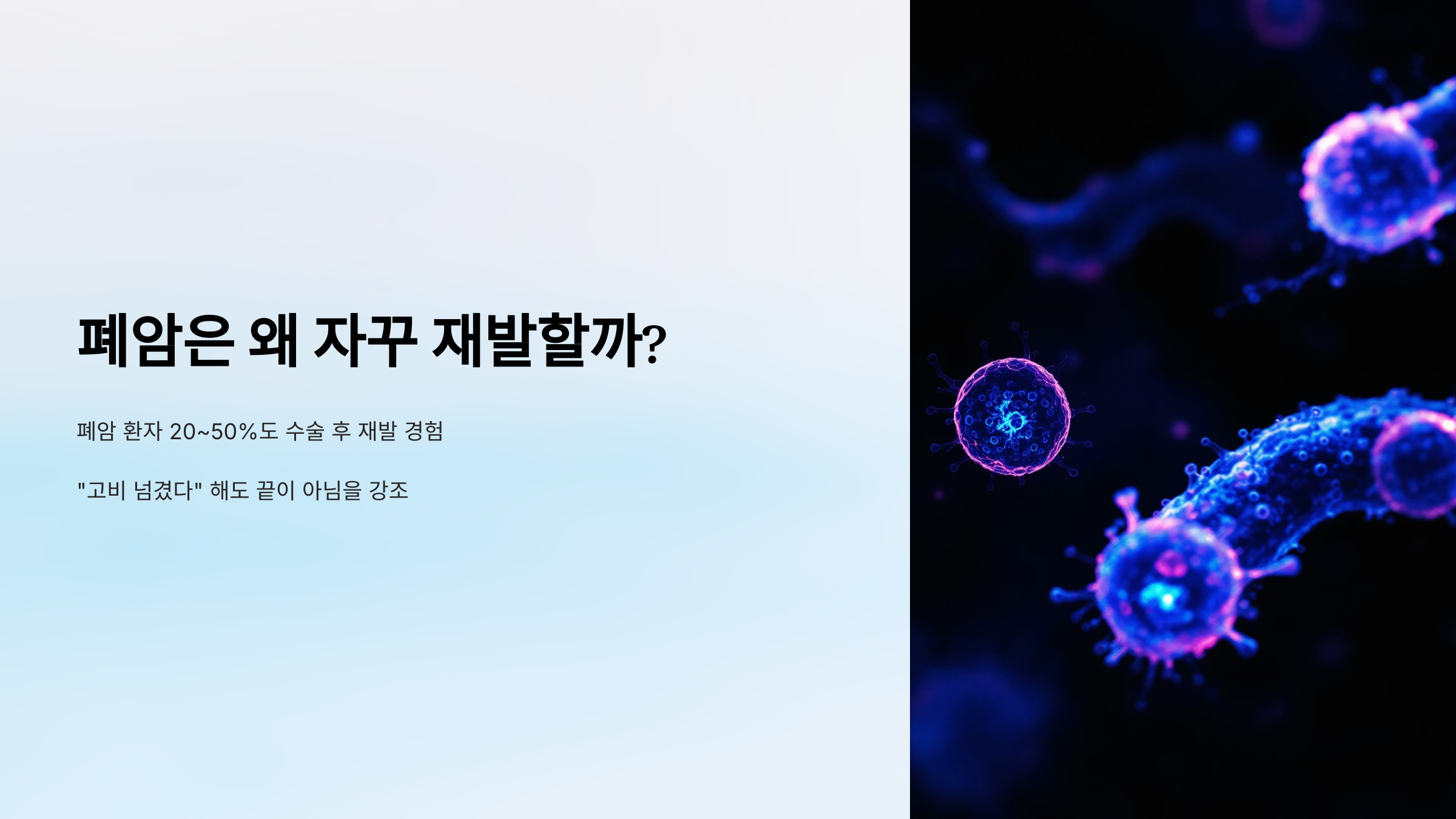 폐암은 왜 자꾸 재발할까?