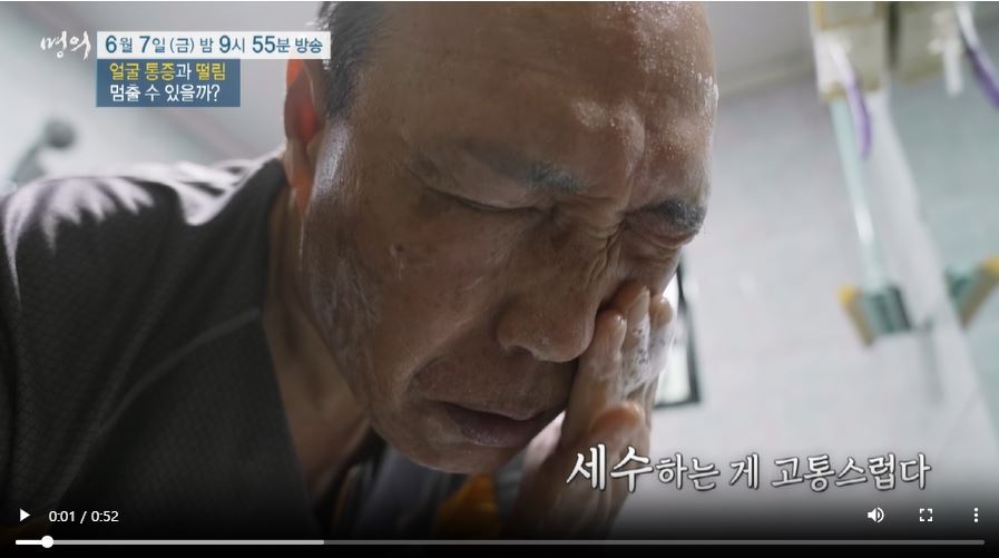 EBS 명의 삼차신경통 원인 증상 치료