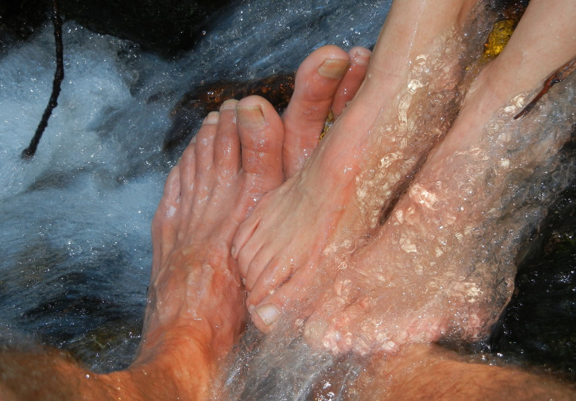 발톱무좀 사진