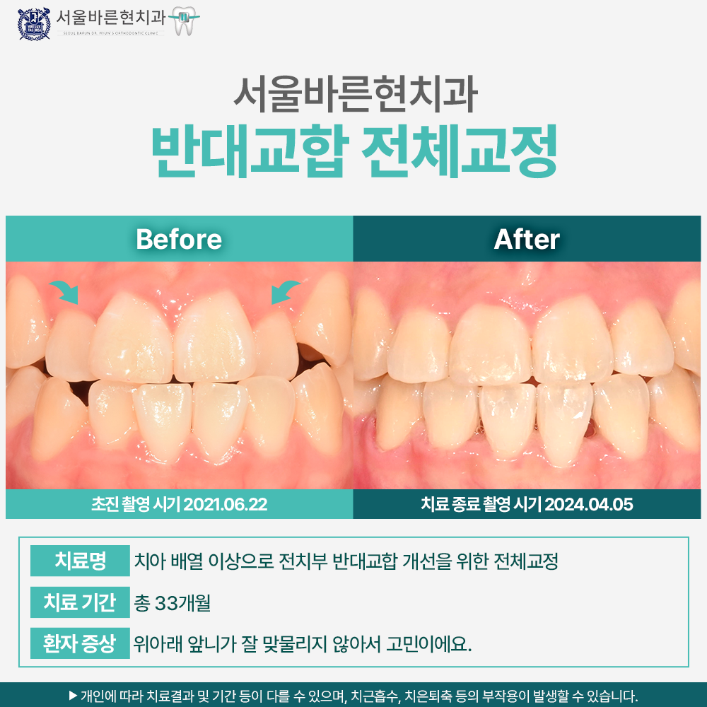 해운대치아교정