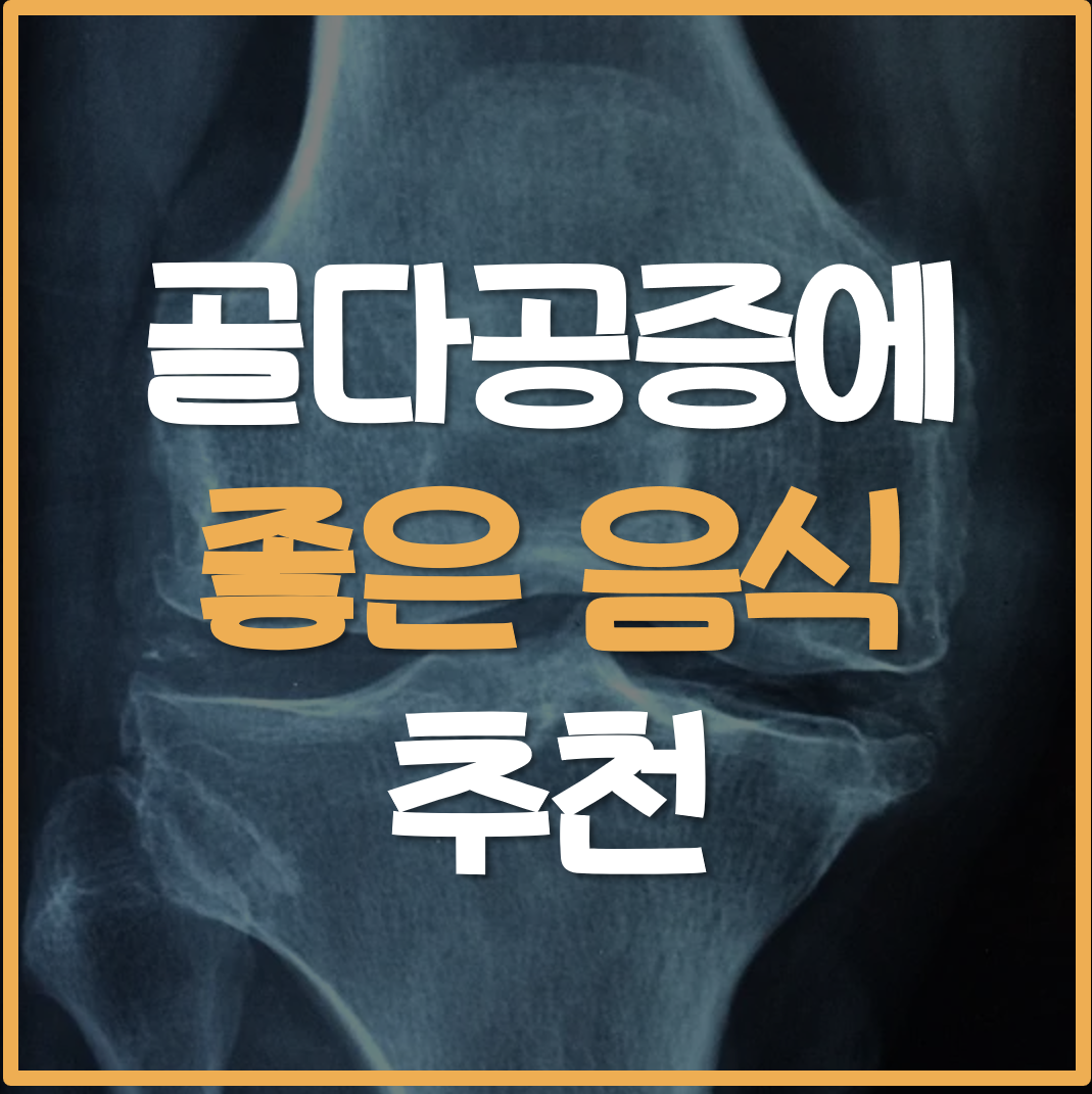 골다공증에-좋은-음식